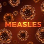 Illustration of measles virus particles with the word 'MEASLES' in bold