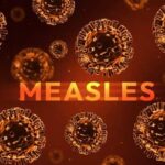 Illustration of measles virus particles with the word 'MEASLES' in bold