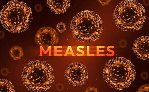 shutterstock_2591304911.jpg Illustration of measles virus particles with the word 'MEASLES' in bold