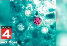 Diarrhea Parasite Tied To Salads? Michigan reports cyclosporiasis outbreak may be linked to lettuce & salad greens