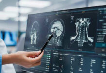 Hero Pilot’s New Fight Stuns Fans Doctor pointing at brain scans on a computer screen.