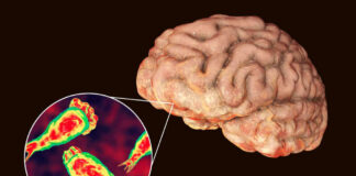 Brain with zoomed-in view of amoeba infection.
