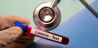 A gloved hand holding a blood test tube labeled 'Listeria - Test'