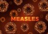 First Measles Death Stuns THIS County Illustration of measles virus particles with the word 'MEASLES' in bold